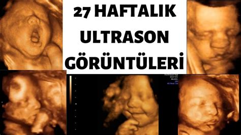 27 Haftalık Gebelik Ultrason Görüntüleri YouTube