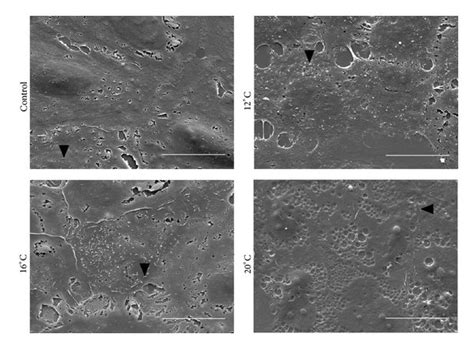 Scanning Electron Photomicrographs Showing Apical Microvilli On Control