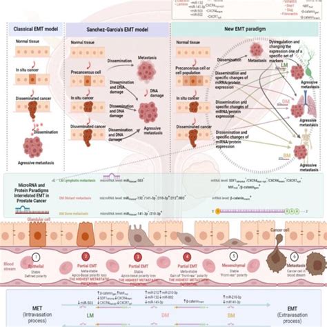 Proposed Models Of The Epithelial Mesenchymal Transition In Prostate