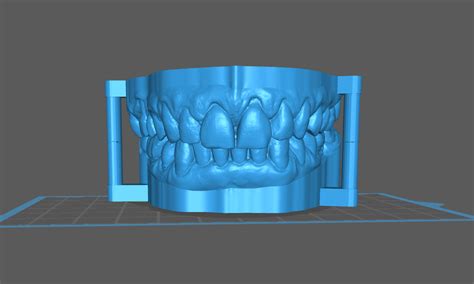 Fichier Stl Mod Les Dentaires Articul Smod Le Imprimable En D