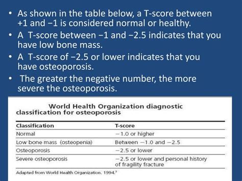 Bone Mineral Density Bmd Test Ppt