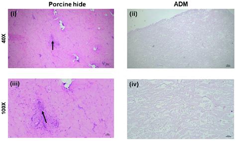 The Characterization Of Adm By H E Staining I Iii Native Porcine