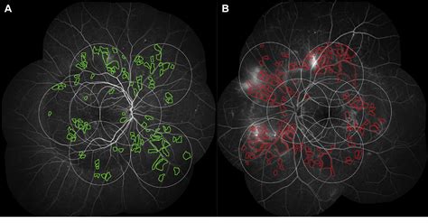 Figure From Kwon Et Al Angptl And Sema E In Dr Measurement Of