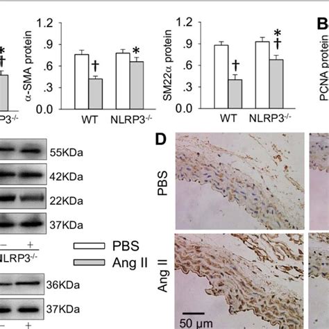 Deletion Of Nlrp Gene Attenuated Ang Ii Induced Phenotypic