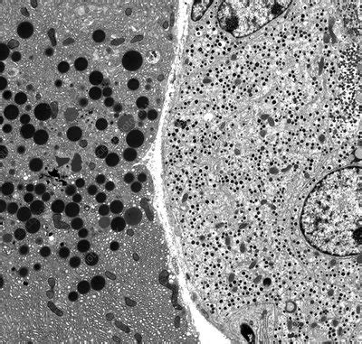 Pancreatic Cells Tem Stock Image C Science Photo Library