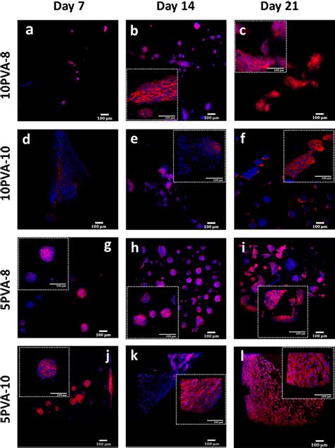 Figure From Novel Pvahyaluronansiloxane Hybrid Nanofiber Mats For