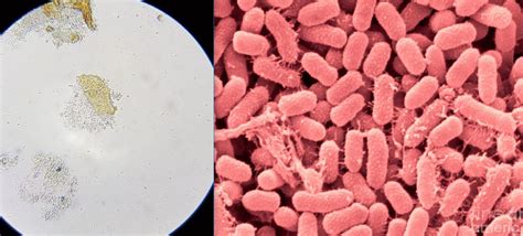 Serratia Marcescens Gram Stain