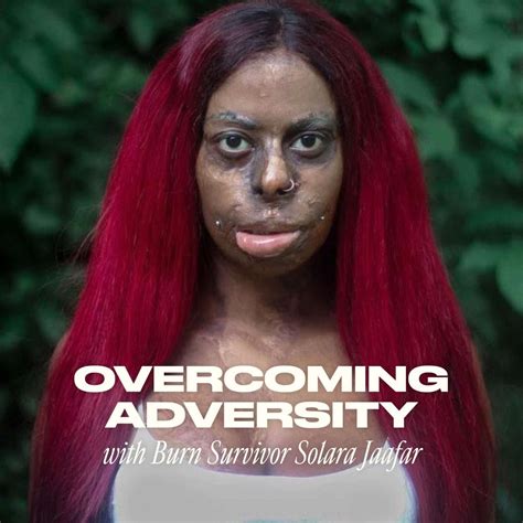 Hannah Louu: Overcoming Adversity