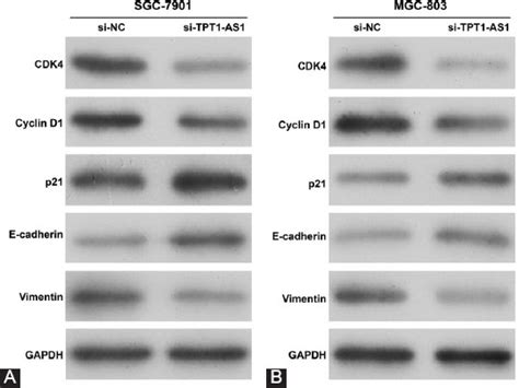 Knockdown Of Tpt1 As1 Inhibits Cell Proliferation Cell Cycle G1s