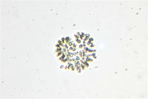 microcystis  microscopic life  shetland lochs