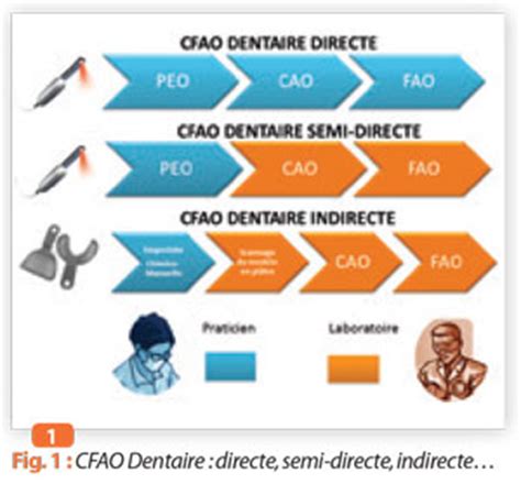 Apports De La Cfao Dentaire