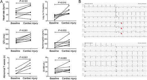 Dynamic Changes Of Electrocardiogram Ecg A The Ecg Parameters And