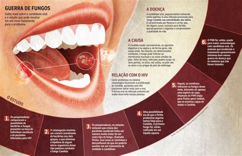 Candid Ase Oral Fotos Imagens Videos E Tratamento Cl Nica Humaire