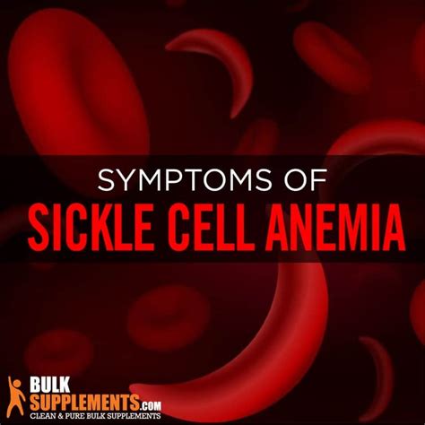 Sickle Cell Anemia Symptoms Causes And Treatment