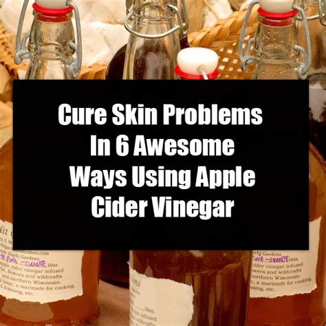 Cure Skin Problems In 6 Awesome Ways Using Apple Cider Vinegar