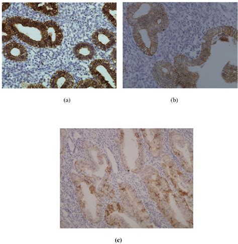 Immunohistochemical Localization Of E Cadherin A Normal Proliferative Download Scientific