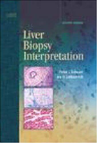 Liver Biopsy Interpretation 9781416026211 Medicine And Health Science