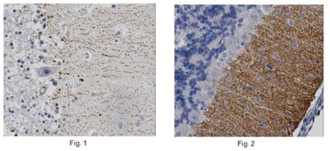 Anti DGL α Antibody from rabbit purified by affinity chromatography