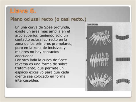 Articulo De Las 6 Llaves De La Oclusion Pdf Descarga Gratuita