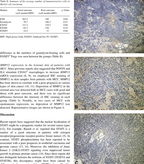 Periostin Expression In The Lesional Skin Of Patients With Merkel Cell