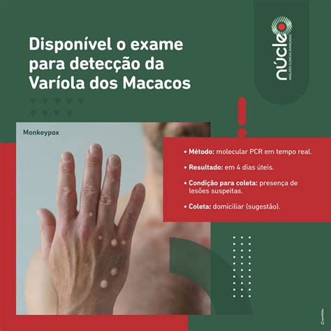 Dispon Vel No N Cleo Laborat Rio O Exame Para Detec O Da Var Ola Dos