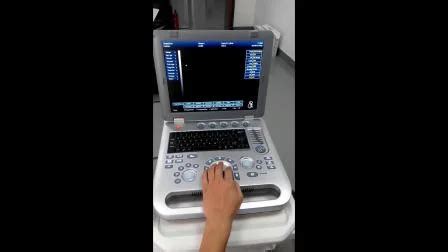 Vascular Portable Ob/Gyn 3D Ultrasound Scan for Pregnancy Baby ...