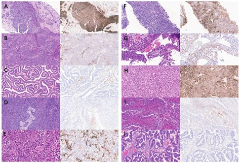 Representative Examples Of Hematoxylin And Eosin Stained Slides Left