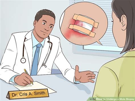 3 Ways to Undergo a Mole Biopsy - wikiHow Health