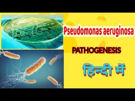 Pseudomonas Aeruginosa Pathogenesis Lab Diagnosis Treatment