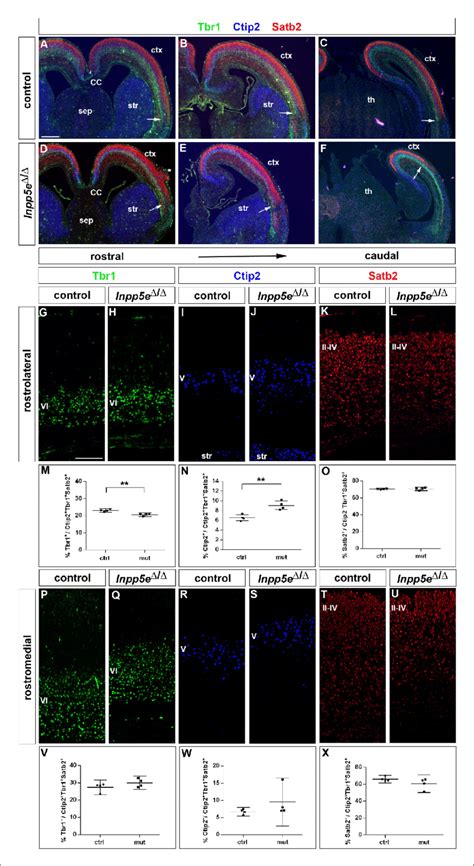 Increased Formation Of Layer V Neurons In E185 Inpp5e Dd Mutants