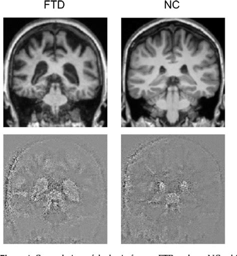 Figure 1 From A Reproducible Deep Learning Based Computer Aided Diagnosis Tool For