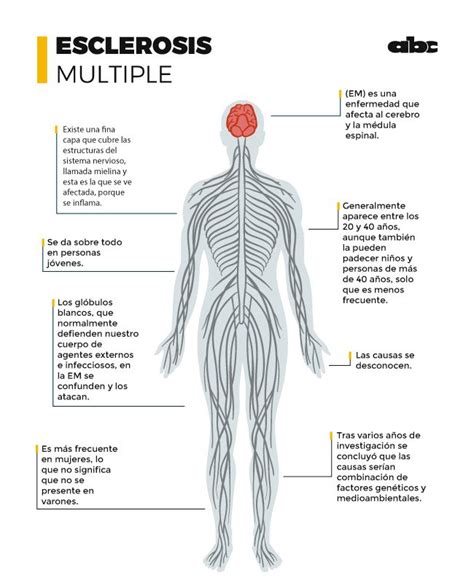 Esclerosis Múltiple Vivir Con Mil Rostros Notas Abc Color