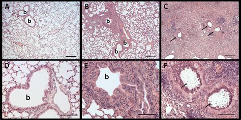 Long Term Chronic Pseudomonas Aeruginosa Airway Infection In Mice Protocol