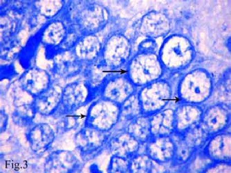 Showing Nissl Granules Content Of The Granule Cells Of Dentate Gyrus