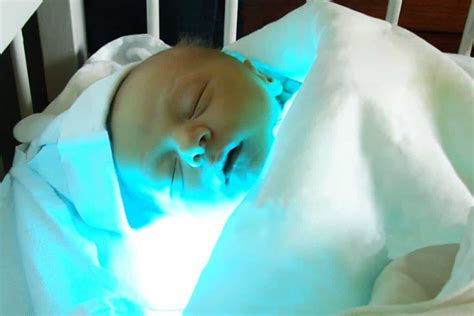 Neonatal Jaundice Symptoms Causes And Treatment 40 Off