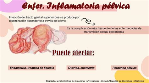 Enfermedad Inflamatoria Pélvica Medicina Óptima Udocz