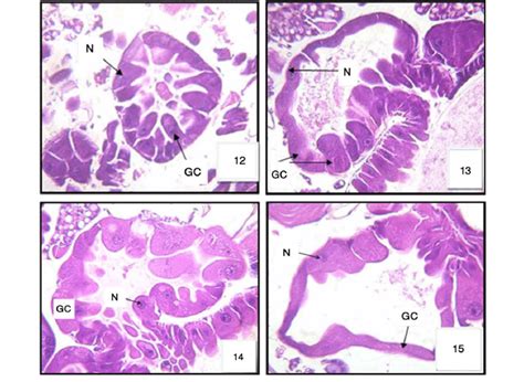 Cross section in gastric caeca (GC) of 3rd larval instar of Cx ...