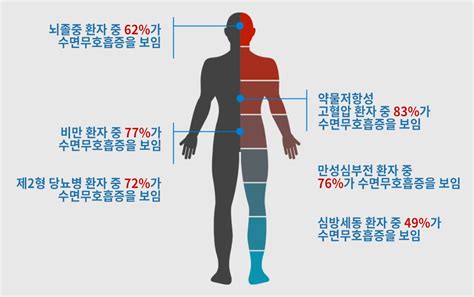 Resmed Korea 뉴스룸 소식유럽인 1억 7500만 명이 수면 무호흡증 겪고 있으며 세계 건강 위기 수준을 주목해야 한다