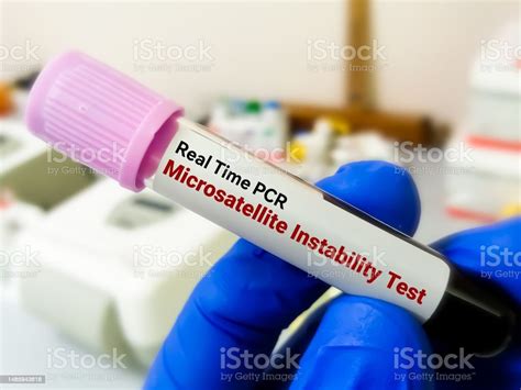 Microsatellite Instability Test Msi Screening Is Used To See The