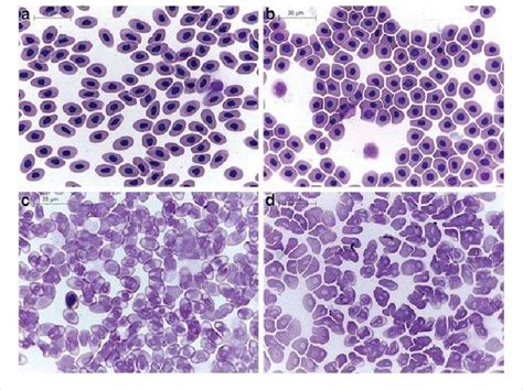 Red blood cell morphology by light microscopy. a Control (without ...