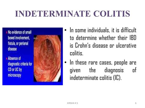 Inflammatory Bowel Disease Ppt