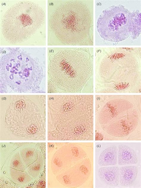 Meiosis Early Prophase 1 Hot Sex Picture