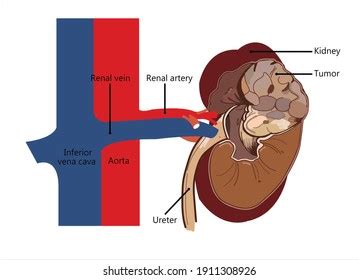 Anatomy Drawing Version Cartoon About Human Stock Illustration ...