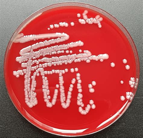 Klebsiella Pneumoniae Morphology