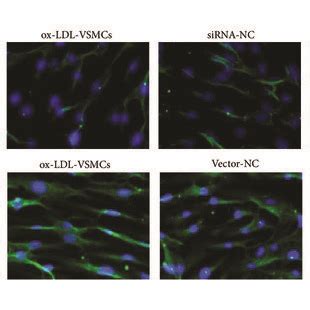 A The Level Of Sma After Sirt Silencing Or Overexpression In