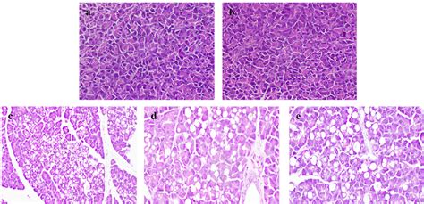 Figure 3 From Pancreatic And Hepatic Histopathology Of High Fat Diet Fed Streptozotocin Induced