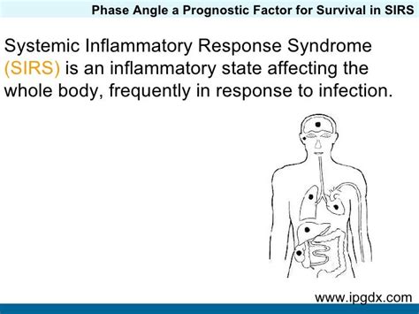 Systemic Inflammatory Response Syndrome Sirs Prognosis