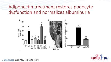 Diabetes Proteinuria And Heart Disease Youtube