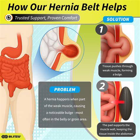 Snapklik.com : Hernia Belt For Bilateral, Double Or Single Inguinal