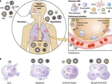 Viral Pneumonia Virus